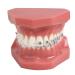 TM-208 Demonstration Orthodontic Model Teeth Teach Study Tools with Metal and Ceramic Bracket(Red)