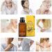 Buy Natural Ginger Massage Oil - Lymphatic Drainage & Cold Relief | 30ml SPA Massage Oil for Relaxation - Buy Online on GoSupps.com