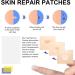 2-in-1 Skin Tag & Mole Remover Kit - Safe & Painless Removal for 2mm-8mm Sized Tags - Easy DIY at Home Green - Buy Online on GoSupps.com