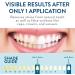 LOVE YOUR TEETH Whitening Kit - LED Blue Light System for Stained Teeth - Home Teeth Whitener - Clinically Tested for 7 Shades Whiter Teeth in 7 Days - Buy Online on GoSupps.com