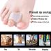 2-Piece Toe Separator Insoles for Hallux Valgus Correction | Orthopedic Foot Care Tools - Buy Online on GoSupps.com