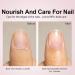 Repairing Oil for Cuticles and Nails | Nourishing Treatment for Damaged or Broken Nails 15ml - Hand and Nail Care for Women and Men Convenient Travel Size - Buy Online on GoSupps.com