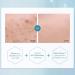 Pyunkang Yul Acne Spot Cream 0.50 fl oz | Targeted Acne Treatment - Buy Online on GoSupps.com