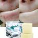 Lucoss Natural Sea Salt Soap with Goat Milk Blackhead and Acne Scars Anti Cellulite Soap Face for Dry and Oily Skin Natural - Buy Online on GoSupps.com