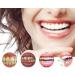 SP-4 Ultra Whitening Toothpaste - Probiotics Formula for Fresh Breath & Bright Smile | Pasta Dental SP-4 - International Shipping Available - Buy Online on GoSupps.com
