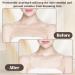 EKIND Silicone Chest Patch Anti Wrinkle D collet Pad Reusable Self Adhesive T Shape Skin Tightening Hydrating Lift for Women (Transparent) - Buy Online on GoSupps.com