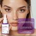 3PCS Vitamin B3 Facial Serum Dark Spots Remover Fade Marks Freckle Melanin Correcting Anti Pigmentation Brighten Care Essence - Buy Online on GoSupps.com