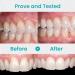 Lovilds Zefux Neslemy Dentiz & Fivfivgo Gum Therapy Gel | 2PCs for Optimal Gum Health | International Shipping - Buy Online on GoSupps.com