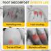 2023 Silicone Anti-Friction Toe Protectors - Breathable Covers for Toe Relief & Protection (Pack of 10) - Buy Online on GoSupps.com
