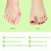 Gel Bunion Toe Separators | Silicone Spacers for Overlapping Toes | Breathable Foot Pain Relief for Men & Women - Buy Online on GoSupps.com