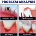 20ml Toothache Relief Spray - Effective Dental Pain Treatment for Teeth & Gums (2PCs) - Buy Online on GoSupps.com