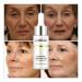 Face Peptides Serum Oil for Skin Lift & Firming Care | Eliminates Fine Lines | Moisturizing | Packaging Upgrade - White - Buy Online on GoSupps.com