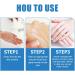 Finxenow ASMOXA Silicone Scar Gel - Effective C-Section & Stretch Mark Scar Remover - 3PCS - Buy Online on GoSupps.com
