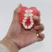 Buy Multifarious Dental Models for Teaching & Studying | Removable Teeth Implant & Orthodontic Demo Models (M7008) - Ideal for Dentists & Students - Buy Online on GoSupps.com
