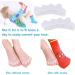 JYCCH Kids Gel Toe Separators - Correct Overlapping Toes | 2 Pack (White & Beige) - Improve Comfort & Alignment - Buy Online on GoSupps.com