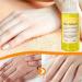 100ml Super Strong Yellow Peeling Oil - Brightening Scrub for All Skin Types | Unisex Body Care - Buy Online on GoSupps.com