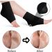 Jootuepo Gel Socks - 3 Pairs Soft Open Toe Heel Socks for Cracked Skin - Foot Care Treatment (Black) - Buy Online on GoSupps.com