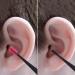 Waitlover Ear Wax Removal Kit - Ear Pick Cleaning Tool for Healthier Ears - Buy Online on GoSupps.com