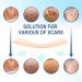 Silicone Scar Sheets - Reusable & Effective for Scar Removal - Pack of 6 Silicone Removal Strips for Surgical Scars, Keloids, C-Section, Tummy Tuck - Scar Tape - Buy Online on GoSupps.com