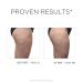 IDC Dermo Profil Cellulite Anti-Cellulite Body Sculpting Gel - Vegan Caffeine Treatment for Legs Stomach Arms & Thighs - 5 fl oz Body Firming & Toning Solution - Buy Online on GoSupps.com