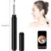 BA1 Ear Wax Removal Tool with Camera - 1080P Wireless Ear Otoscope Kit for Earwax Removal - Compatible with iPad & Android - Includes 12 Silicone Ear Tips - Black - Buy Online on GoSupps.com