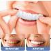 MIIKUU Temporary Cosmetic Veneers - 2 Pairs of Fake Teeth for Men & Women | Lightening Dentures & Prostheses Set - Buy Online on GoSupps.com