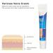 Varicose Veins Cream | Eliminate Spider Veins & Soothing Treatment - International Shipping - Buy Online on GoSupps.com