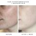 HERBIVORE Milky Way Exfoliating Serum 10% AHA | Vegan Cruelty-Free Glow Formula with Ceramides & Hyaluronic Acid | International Shipping 30mL - Buy Online on GoSupps.com