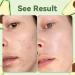 ANAI RUI Green Tea Face Mask with Avocado Clay - 120g / 4.23 oz | Acne Detox, Deep Cleanse, Hydrating, Nourishing & Soothing Skin Care - Buy Online on GoSupps.com