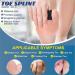 Toe Splints for Straightening Toes | Adjustable Toe Corrector Brace for Men & Women | 2Pcs for Injuries Fractures & Sprains - Buy Online on GoSupps.com