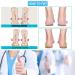 Silicone Medial & Lateral Heel Wedge Insoles - Correct Supination & Pronation, Alleviate Knock Knee Pain, Bow Legs, O/X Type Leg - 3 Pairs - Buy Online on GoSupps.com