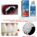 Buy New Temporary Tooth Repair Kit - DIY Play Dough for Easy Fake Teeth Replacement | Best Temporary Restoration Solutions - Buy Online on GoSupps.com