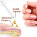 7 Days Nail Growth and Strengthening Serum Natural Nail Growth And Strength Serum Nail Repair Solution for Damaged and Discolored Nails Promotes Rapid Growth & Avoids Flaking (1pcs) - Buy Online on GoSupps.com