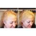 FIXDEEP Hair Thickener | Waterproof Formula for Fuller & Natural Looking Hair | 30 sec Transformation | 14g - Hair Fibers for Thinning, Bald Spots & Graying Roots (Dark Brown) - Buy Online on GoSupps.com