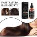 Alopecia Hair Growth Oil for Women & Men | Natural Hair Loss Treatment Serum | Fast-Acting Vegan Scalp Fertilizer - Buy Online on GoSupps.com