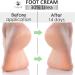Eylleaf 30% Urea Foot Cream 200ml - Repair Dry Feet & Cracked Heels - Buy Online on GoSupps.com