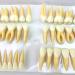 BEAGHTY 2.5x Magnified Tooth Shape Model - 2-Color Dental Structure & Denture Model for Study & Teaching - Buy Online on GoSupps.com