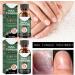 Antifungal Nail Treatment for Damaged Nails - Toe Care Solution for Renewing Discolored Feet - Buy Online on GoSupps.com