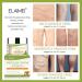 Natural Varicose Veins Cream | Effective Treatment for Tired Heavy Legs | Improve Blood Circulation - Buy Online on GoSupps.com