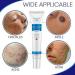 Mark Removal Pro Pimple Ointment - Organic Face Moisturizer for Blemish, Scar, and Spot Removal (White, One Size) - Buy Online on GoSupps.com