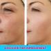 Ceessting Vitamin C Serum for Face - Anti-Aging Serum with Hyaluronic Acid & Vitamin E - 1 oz - Buy Online on GoSupps.com