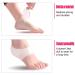 Brillistar Silicone Gel Socks - 2 Pair Heel & Ankle Sleeve for Plantar Fasciitis Relief | Comfortable Foot Pain Relief for Men & Women - Buy Online on GoSupps.com