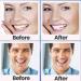 Teeth Whitening Strips - 56 Pcs for Sensitive Teeth | Effective & Safe Whitening | Reduce Sensitivity | Remove Stains | 28 Treatments - Buy Online on GoSupps.com