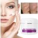 Scar Removal Cream with Plant Extract Stretch Marks & Scars Repair Gel 50ml for Fading Scar and Remove Stretch Marks - Buy Online on GoSupps.com