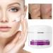 Scar Removal Cream with Plant Extracts - Fades Scars, Stretch Marks & Skin Damage - Buy Online on GoSupps.com