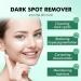 Dark Spot Cream for Face Dark Spot Cleansing Cream for Face & Body Dark Spot Cream Cleansing Spot Pigmentation Darkness -All Skin Types (50ml/1.7 fl oz) - Buy Online on GoSupps.com
