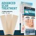 Sialicess Reusable Silicone Scar Strips for Keloid & Hypertrophic Scars - 2 Month Supply - 4 PCS - Buy Online on GoSupps.com