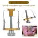 Anself Professional Ingrown Toenail Correction Tool | Gold Toenail Treatment & Pedicure Tool for Effective Care - Buy Online on GoSupps.com