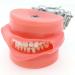 Dental Teeth Model Adult Denture Model with 28/32 Teeth Detachable Teeth Teeth Model Suitable for Research and Teaching for Dental Students Patient Education Display (M8012 + Simulation Cheek) - Buy Online on GoSupps.com