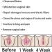 AnnieCare Instant Anti-Itch Detox Slimming Products - 21 Pcs - Stay Clear & Fresh, Tight and Tender State - Buy Online on GoSupps.com